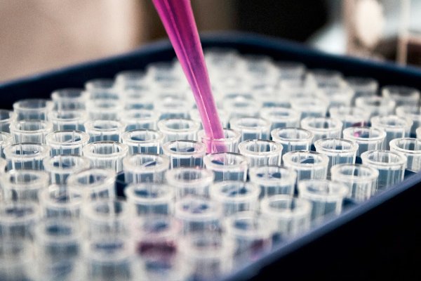 IV Testing Image
